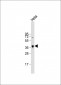 PKA C-alpha/PKA C-beta Antibody (N-term)